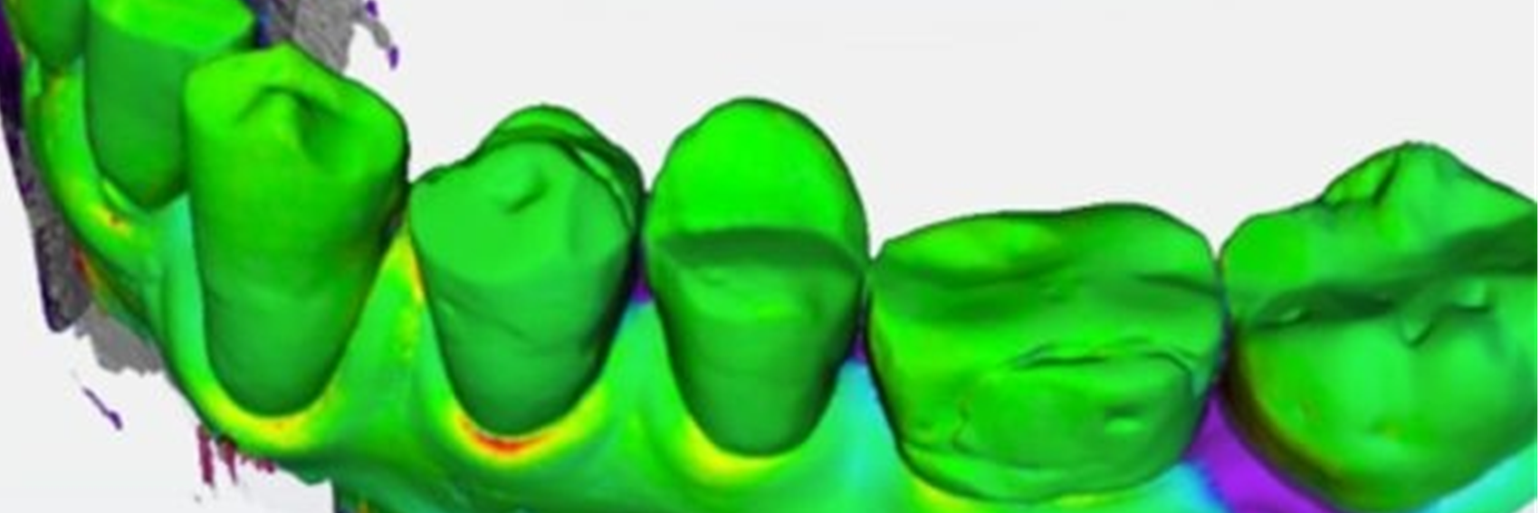 Falschfarbendarstellung einer Zahnreihe im Unterkiefer, Hinweis auf das duale Studiengangsmodell Bachelor OBV mit dem Partner Dentsply Sirona